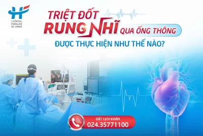 Triệt đốt rung nhĩ qua ống thông được thực hiện như thế nào?